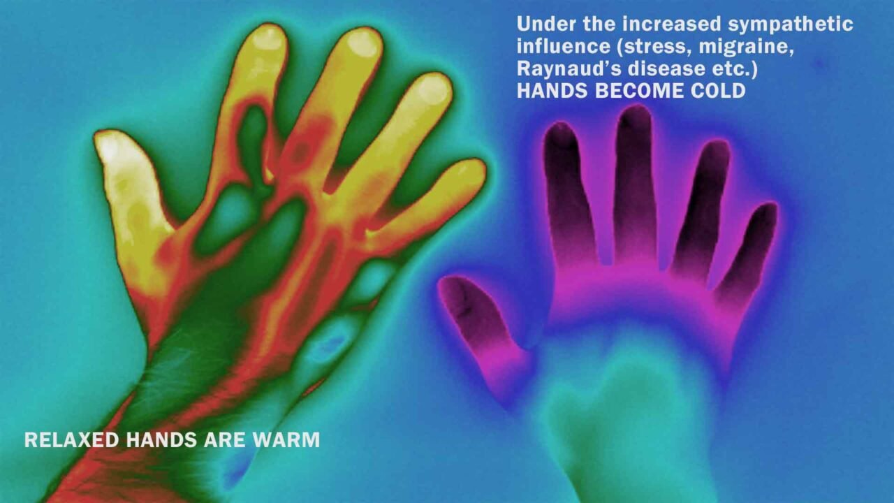 Thermography picture of the hands
