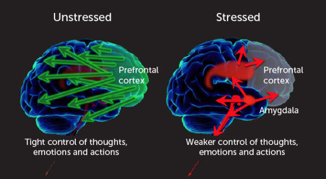 Different Modalities Of Biofeedback In Stress Management 1381