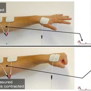 Relaxed/contracted muscle - graph