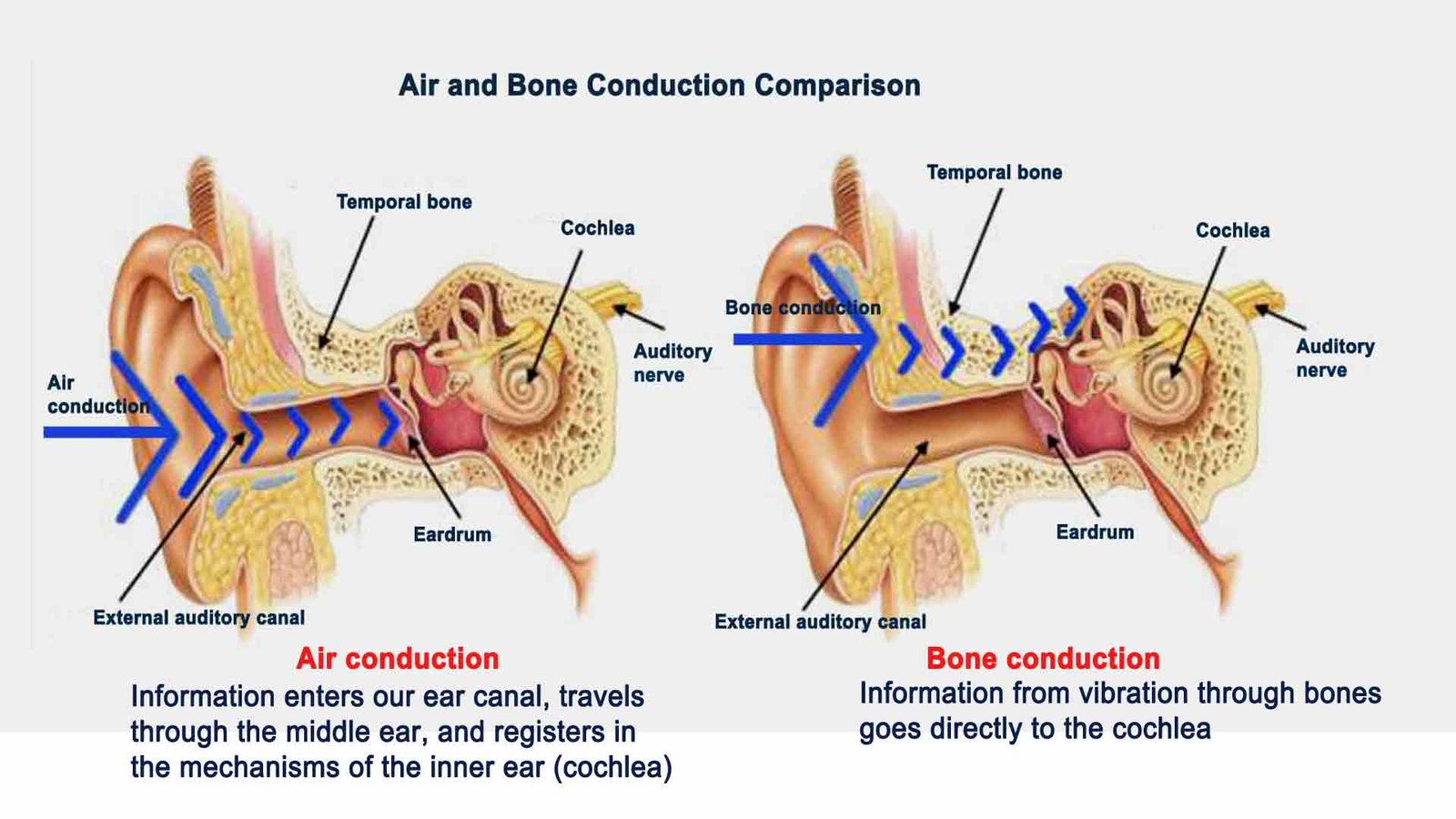 Air and bone conduction comparison