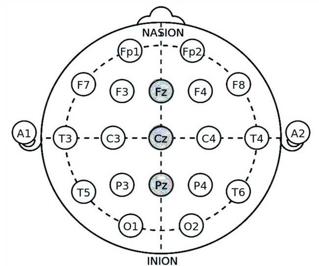 Electrode Location Sites for Alpha-Theta Training in PTSD