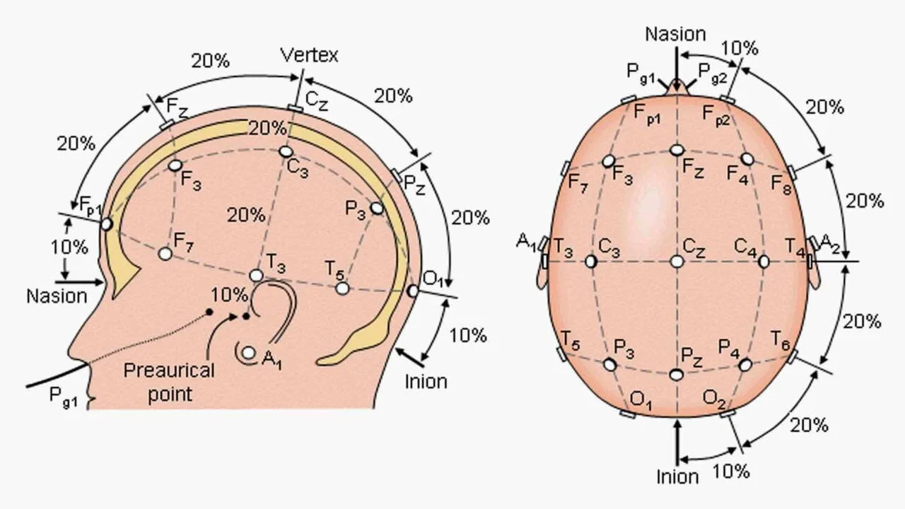 EEG 10-20-system in Neurofeedback therapy - distance measurement