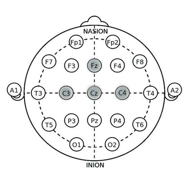 Electrode Application Sites for ADHD Neurofeedback Management