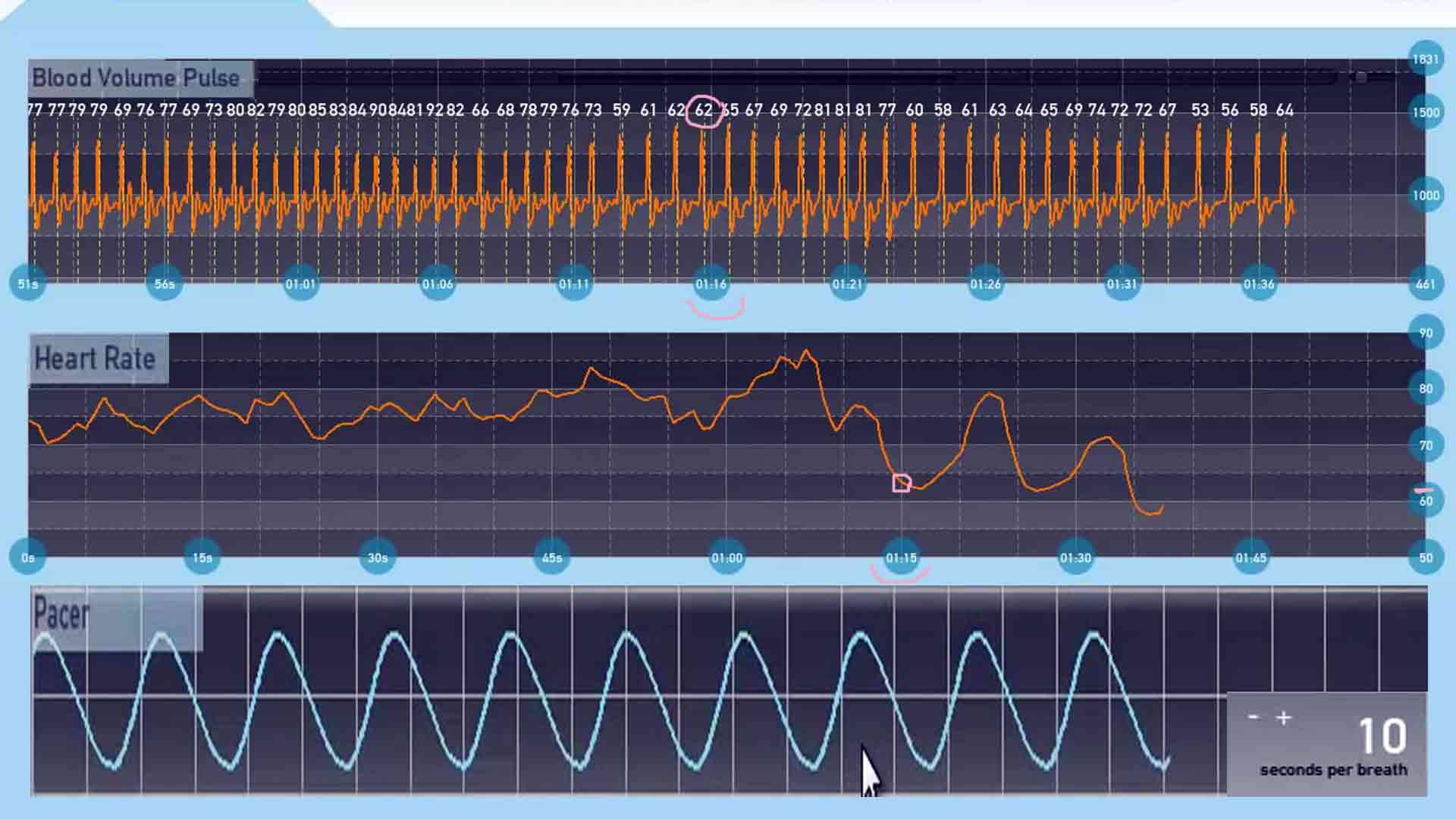 Hrv Biofeedback In Treatment Of Various Pathological States And Disorders