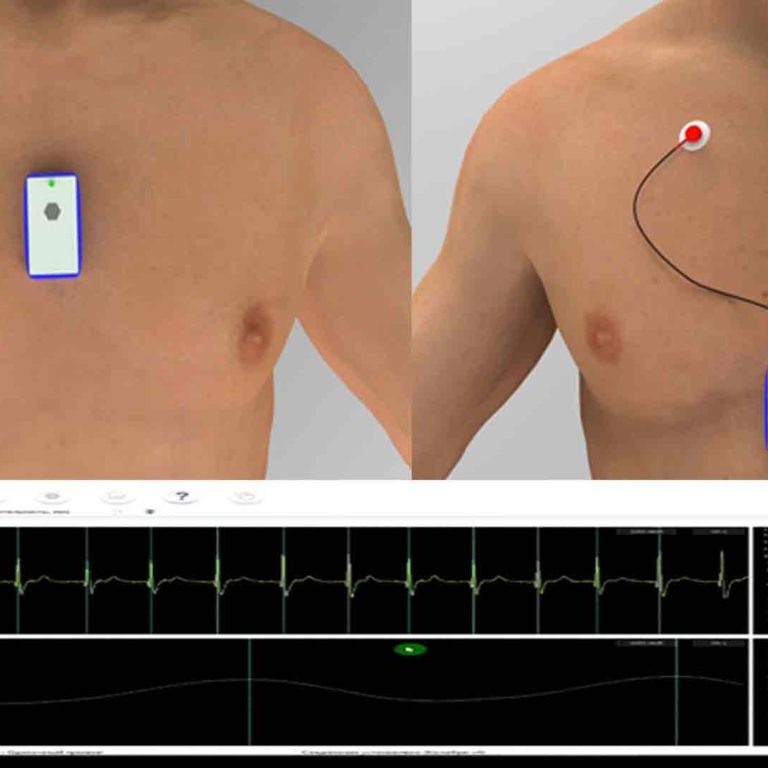 Biofeedback & Neurofeedback Therapy | Control You Performance & Health