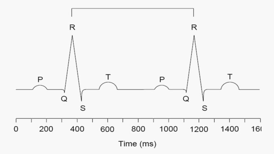 HRV measurement schema