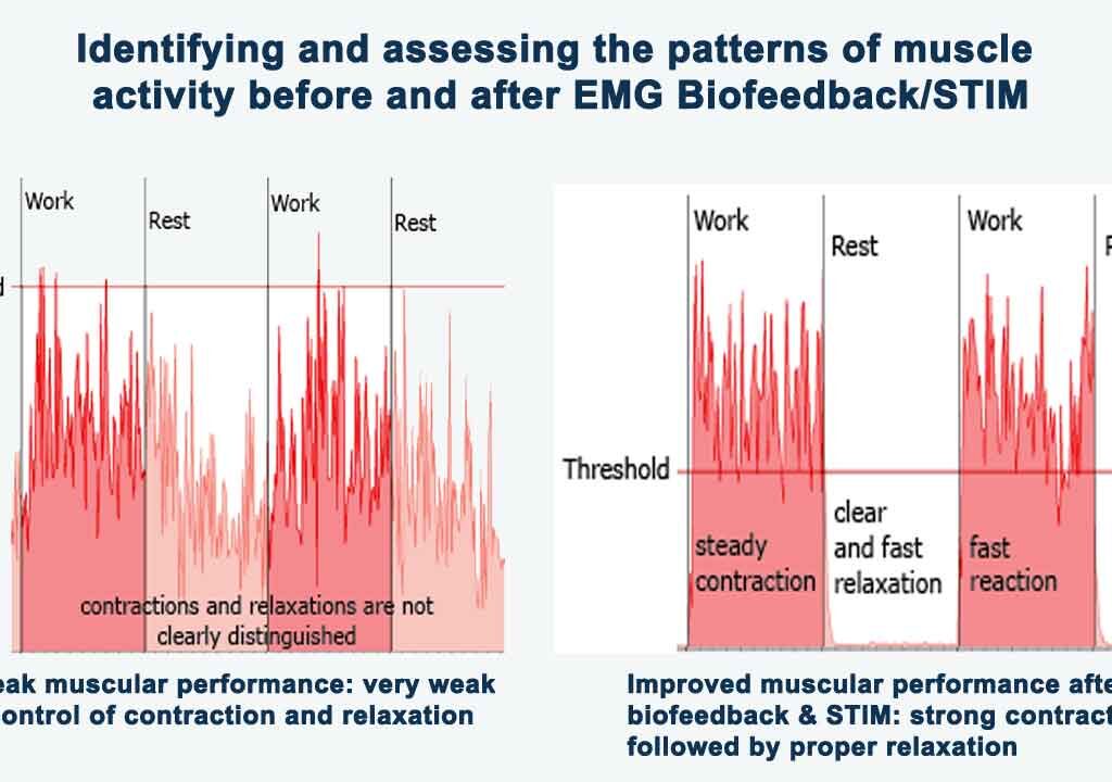 Muscle activity patterns