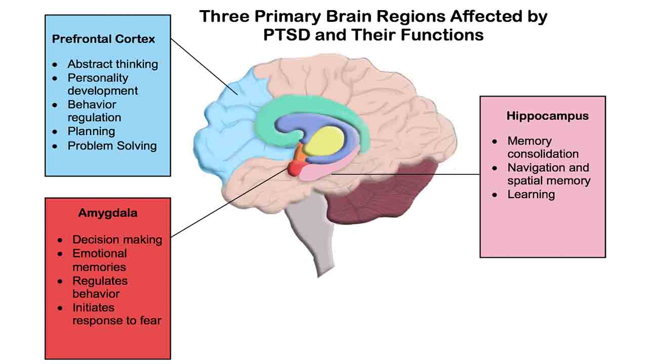 Brain Region Affected by PTSD