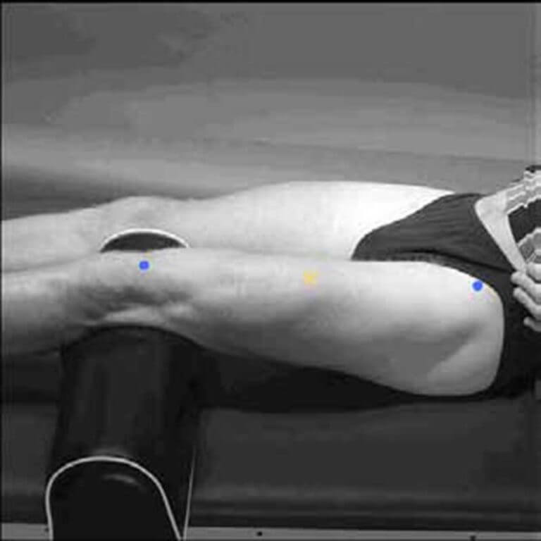 EMG biofeedback, indication, electrode placement sites