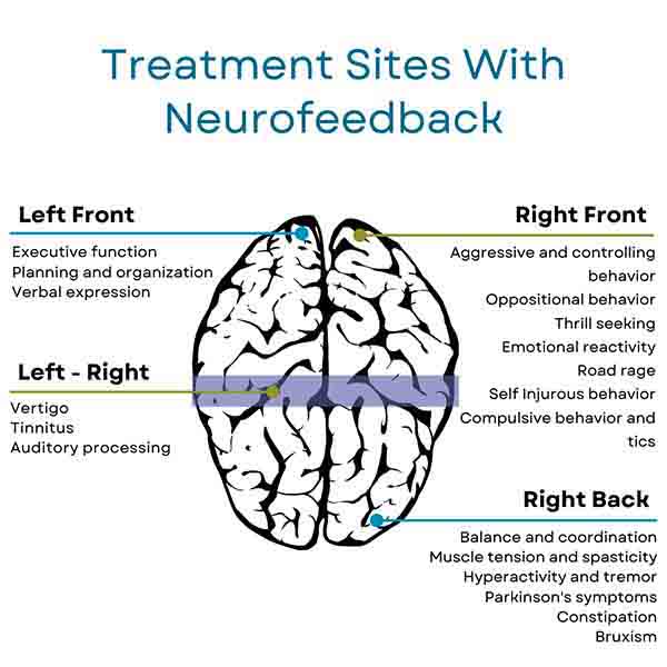 Treatment Sites with Neurofeedback