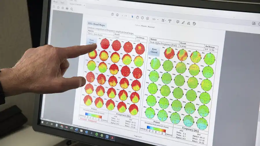 qEEG: brain map diagnostic screen
