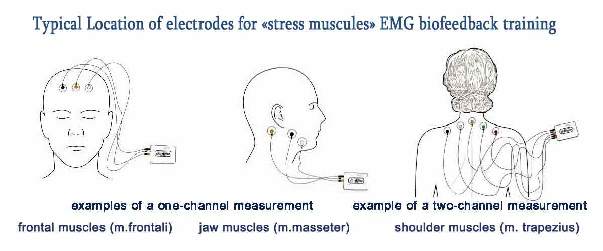 Typical Location of electrodes for stress emg biofeedback